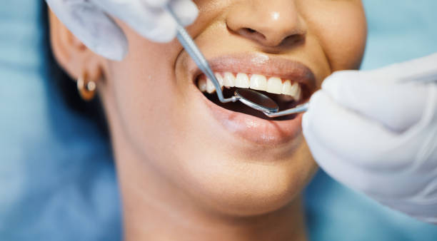 Trusted LA Emergency Dental Service Experts